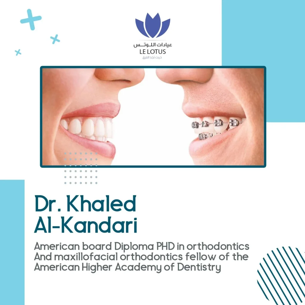 Evolution of orthodontics from metal braces to clear aligners