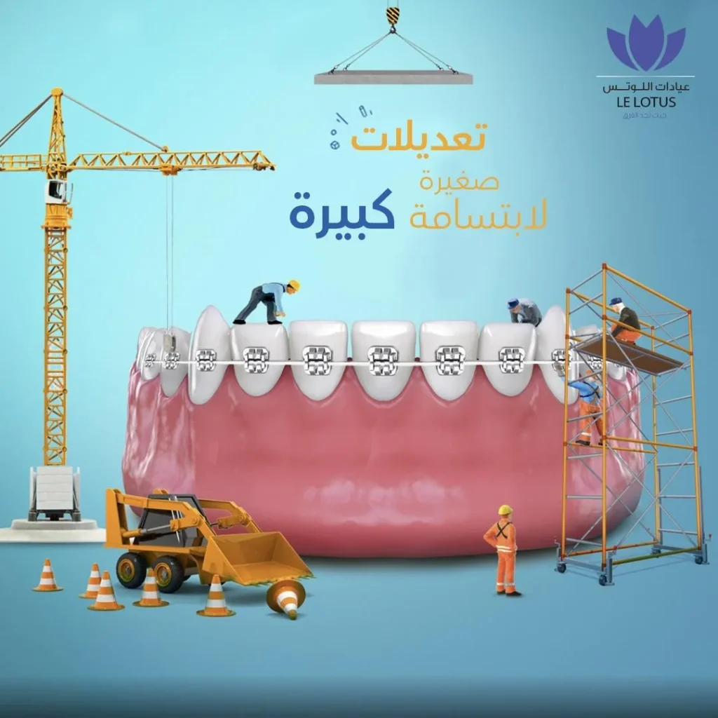 اختيار عيادة أسنان في الكويت مع شرح واضح للخطة العلاجية