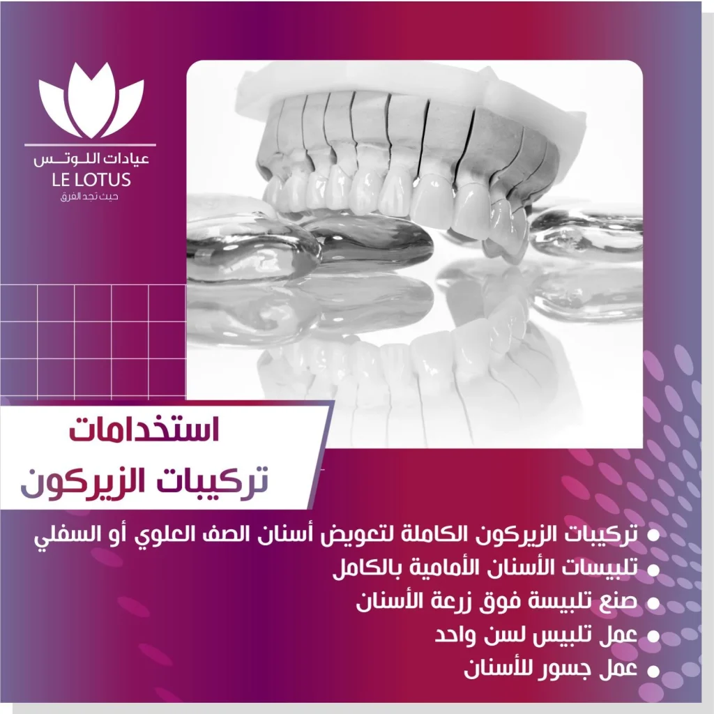 تركيبات الأسنان في الكويت
