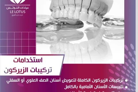 تركيبات الأسنان
